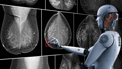 Artificial intelligence and breast cancer