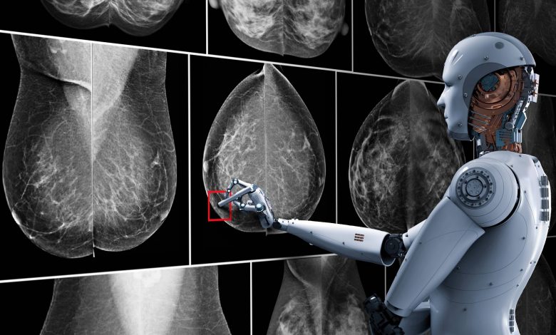 Artificial intelligence and breast cancer